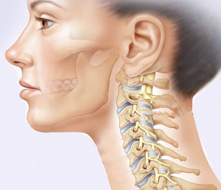 artroza i hernija liječenja vratnih kralježaka