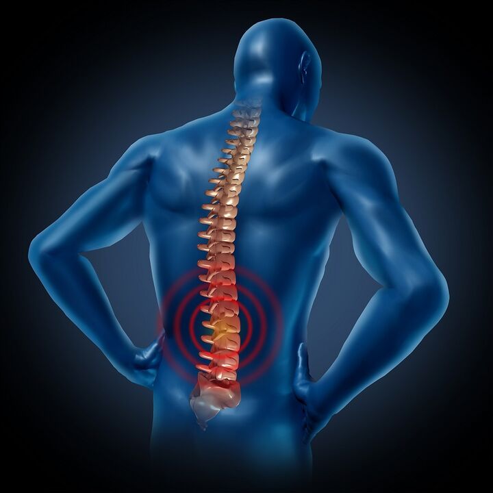 Bolovi u leđima – uzroci, simptomi i liječenje