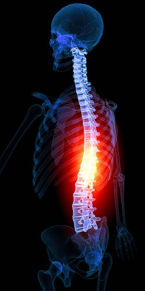 bol s osteohondrozom zgloba kuka bol u zglobovima uzrokuje liječenje