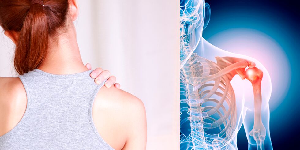 Razvoj osteoartritisa ramena postupno dovodi do stalne boli