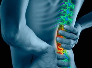 Uzroci i simptomi osteohondroze