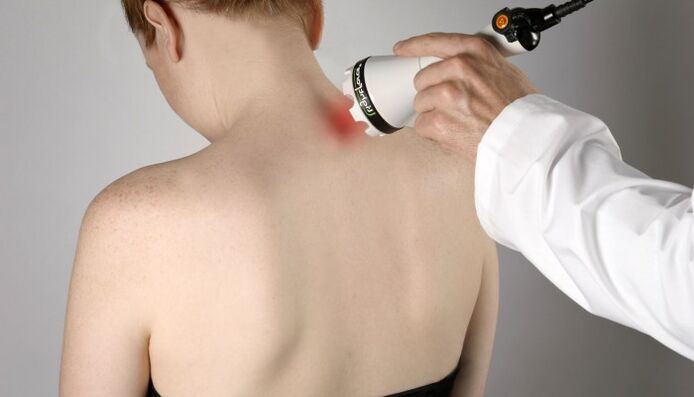 laserska terapija cervikalne osteohondroze