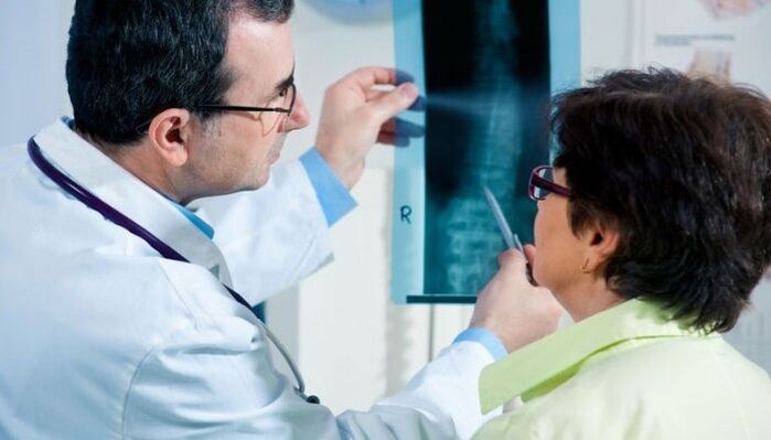 radiografija kao metoda za dijagnosticiranje cervikalne osteohondroze